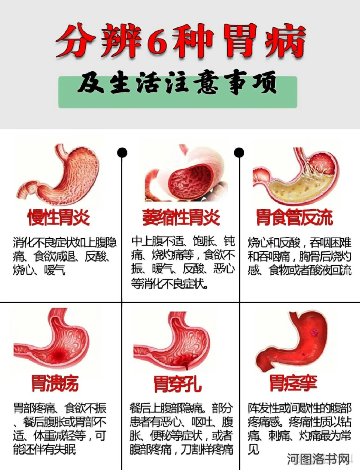 人体消化系统之胃.png